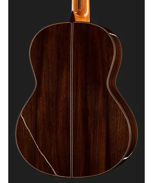 Amalio Burguet 2DV w/Case, lähikuva 5