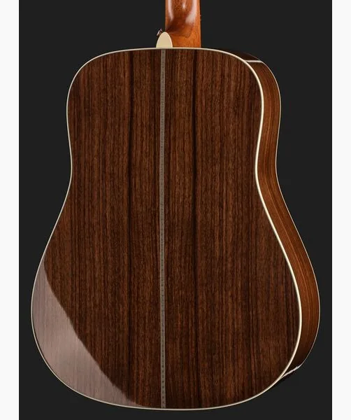 Martin Guitar HD28E LRB, lähikuva 5