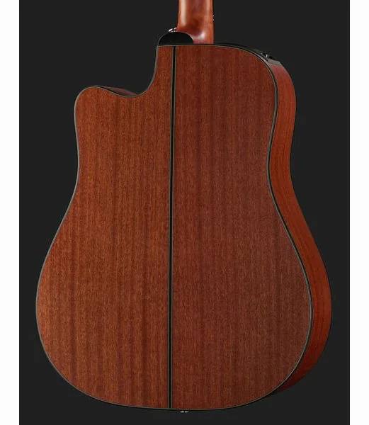 Takamine GD11MCENS, lähikuva 5
